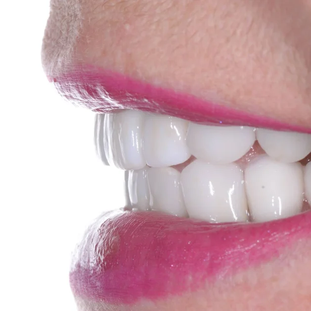 Implantes dentales